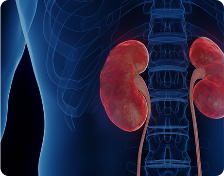 신장/배뇨질환