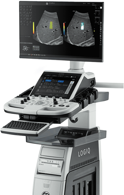 GE LOGIQ-P10 초음파